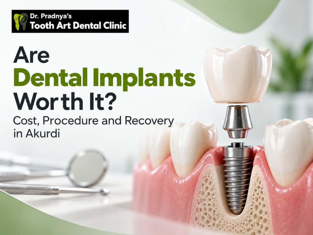 dental implants in Akurdi